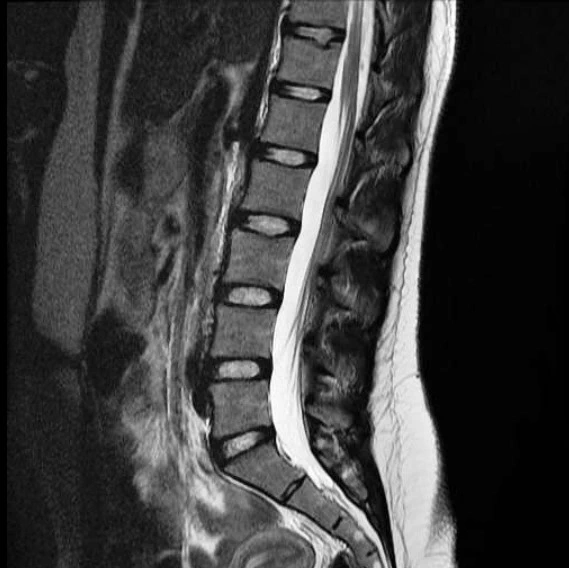 МРТ поперекового відділу хребта в Києві Клініка Док лайф
