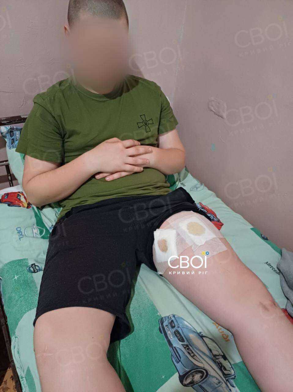 Стріляли в підлітка